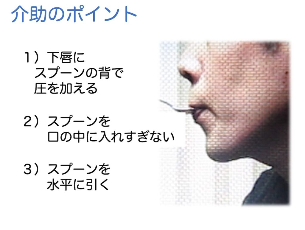 当時のメディア報道・掲載写真